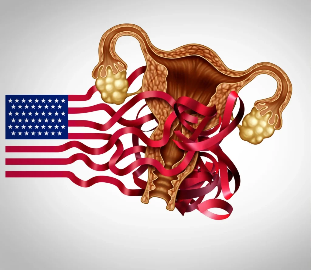 Sekarang Setelah Roe v Wade Dibatalkan, Apa Konsekuensinya?